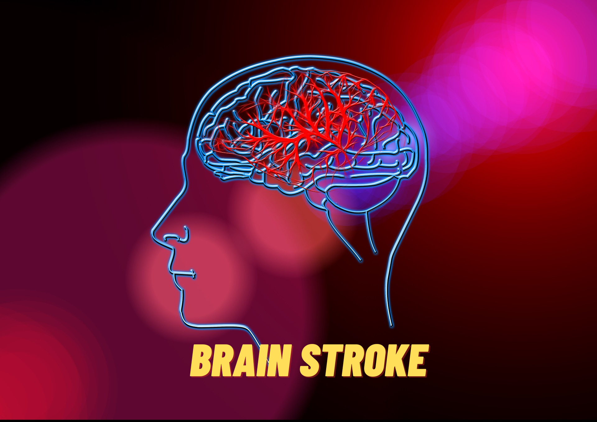stroke-meaning-in-hindi