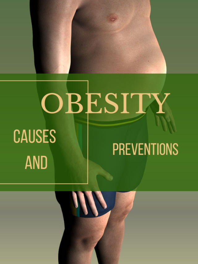 Obesity- Causes And Prevention
